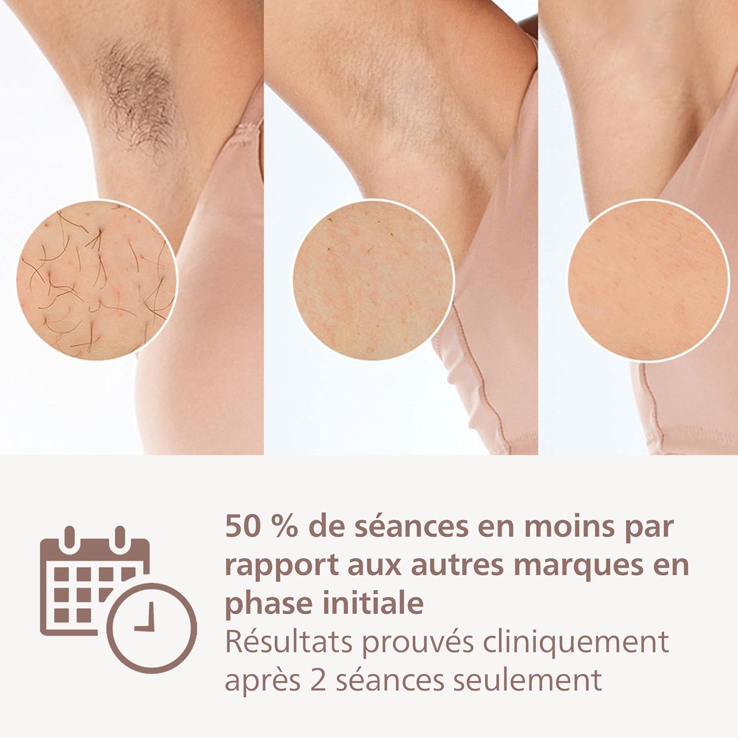 Philips Lumea Série 8000 : l’épilateur à lumière pulsée Philips